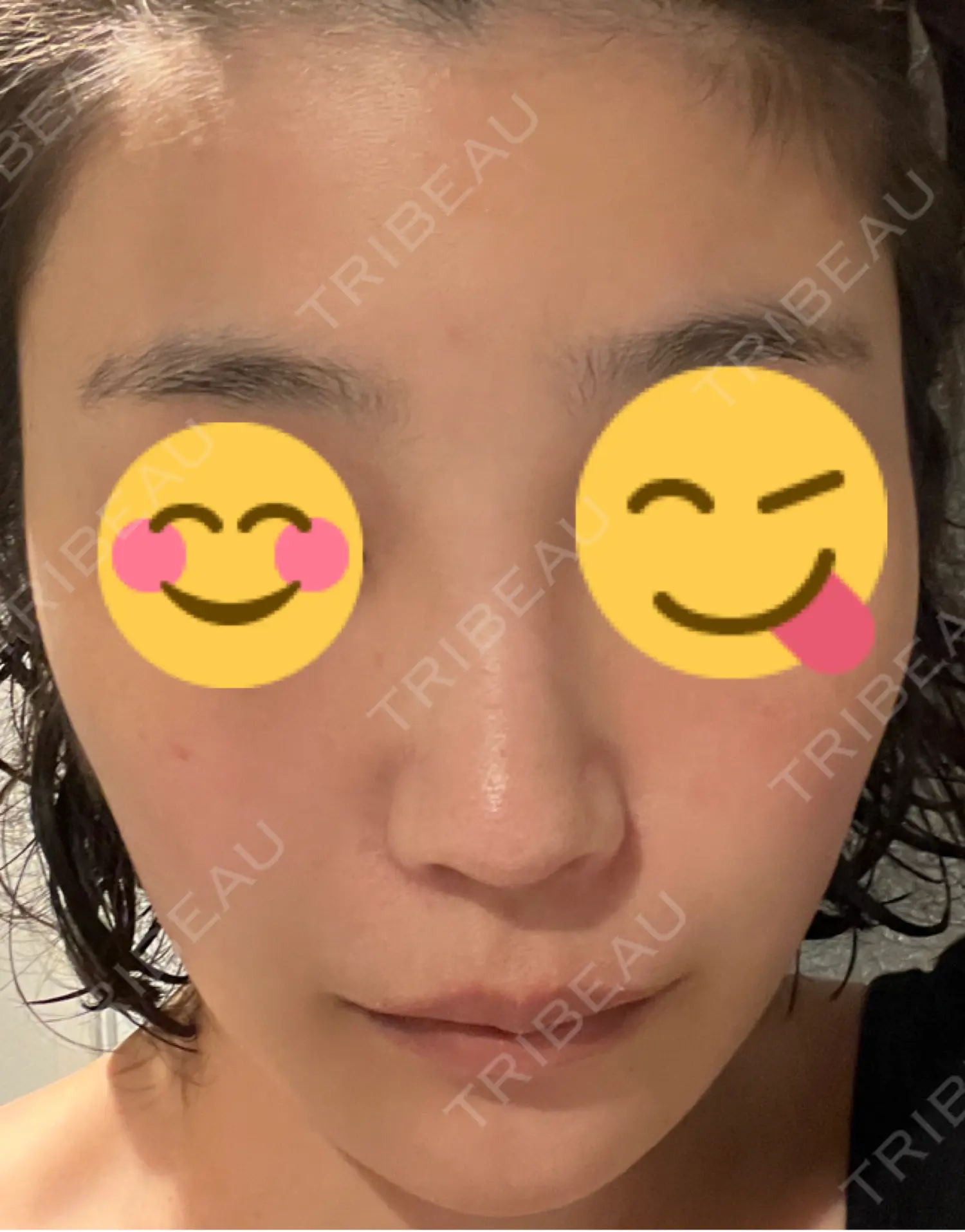 施術前の写真