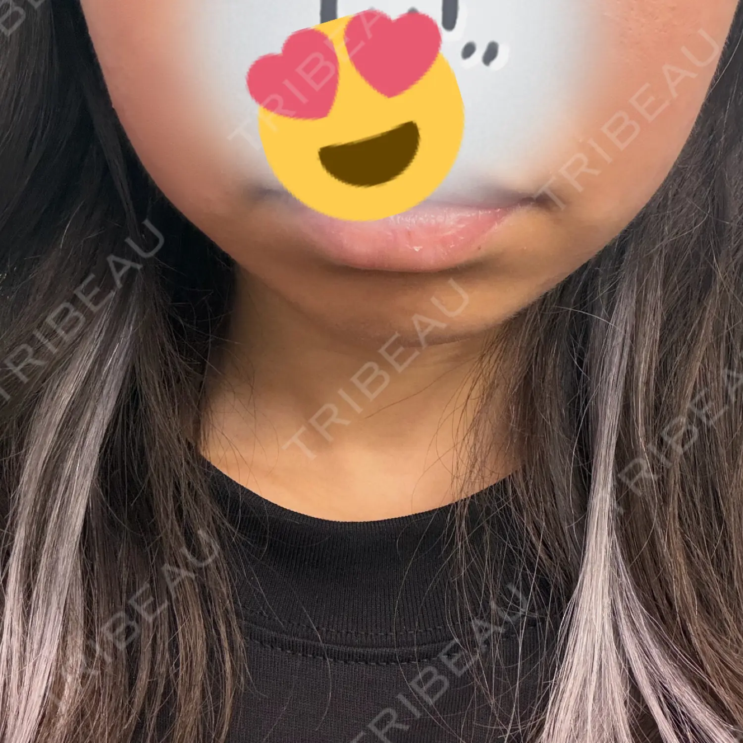 施術前の写真