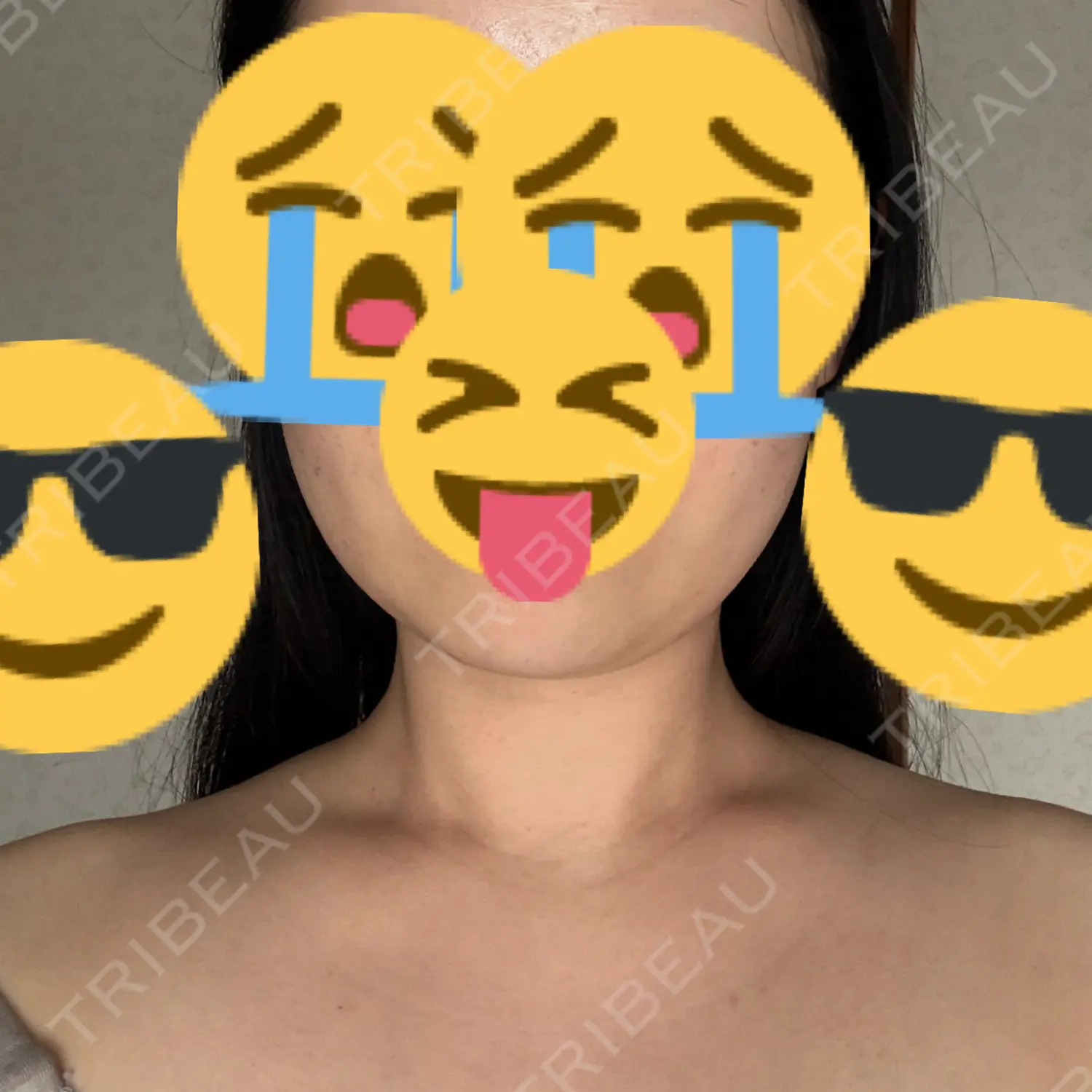 施術前の写真