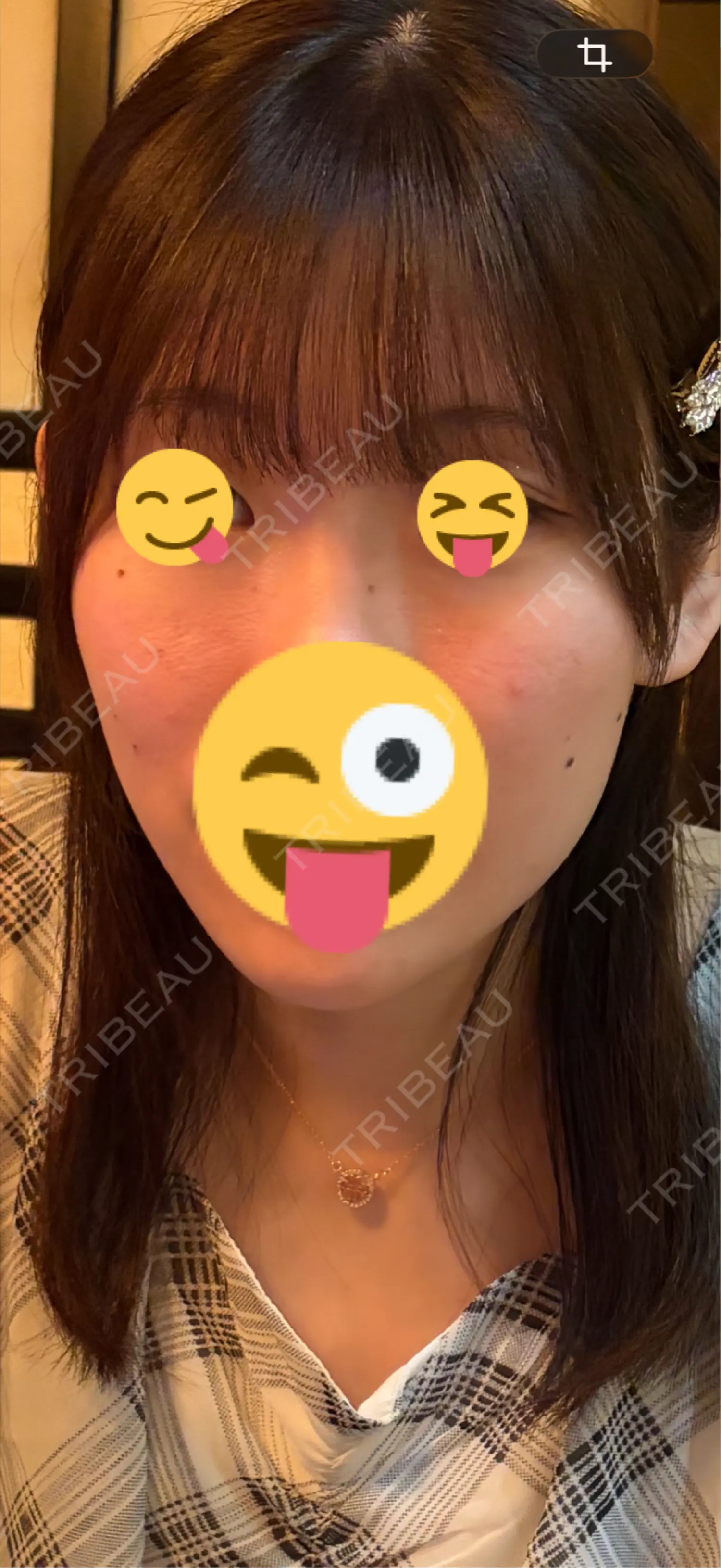 施術前の写真