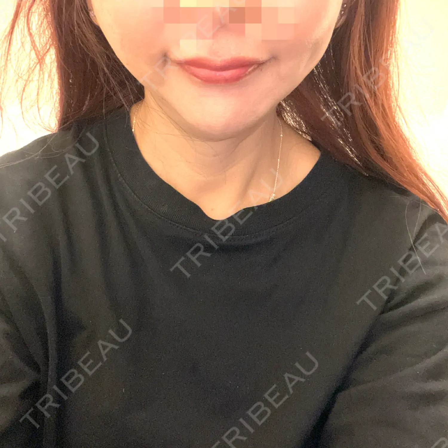 施術前の写真