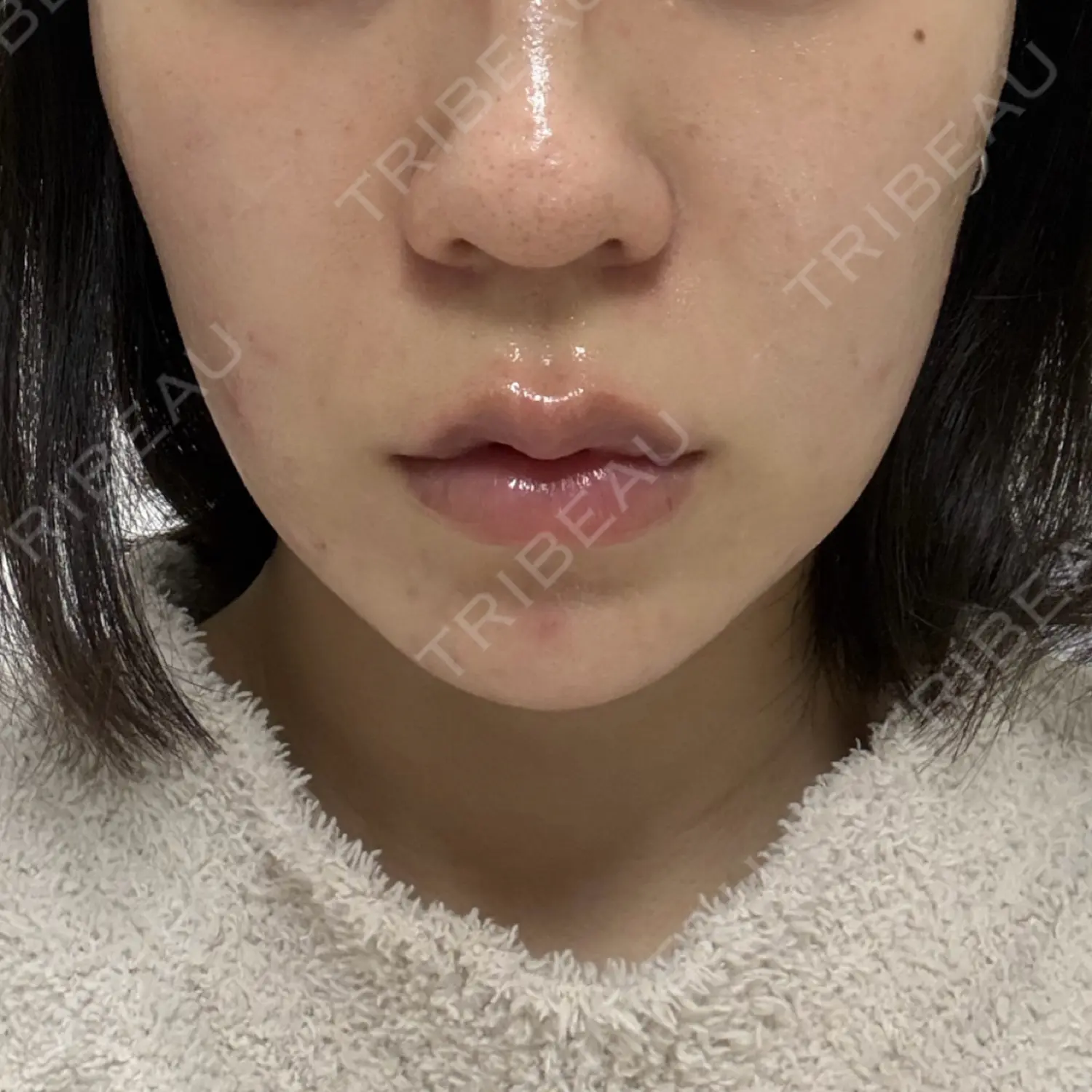 施術前の写真