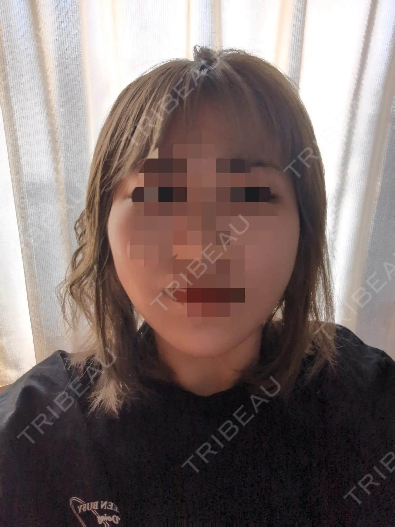 施術前の写真