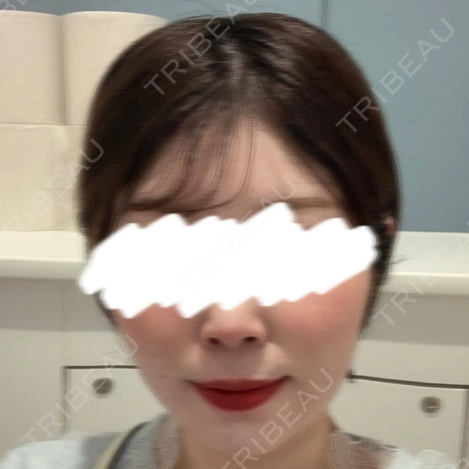 施術前の写真