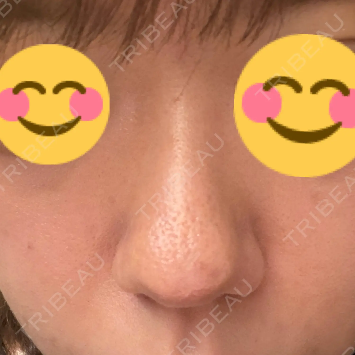 施術前の写真