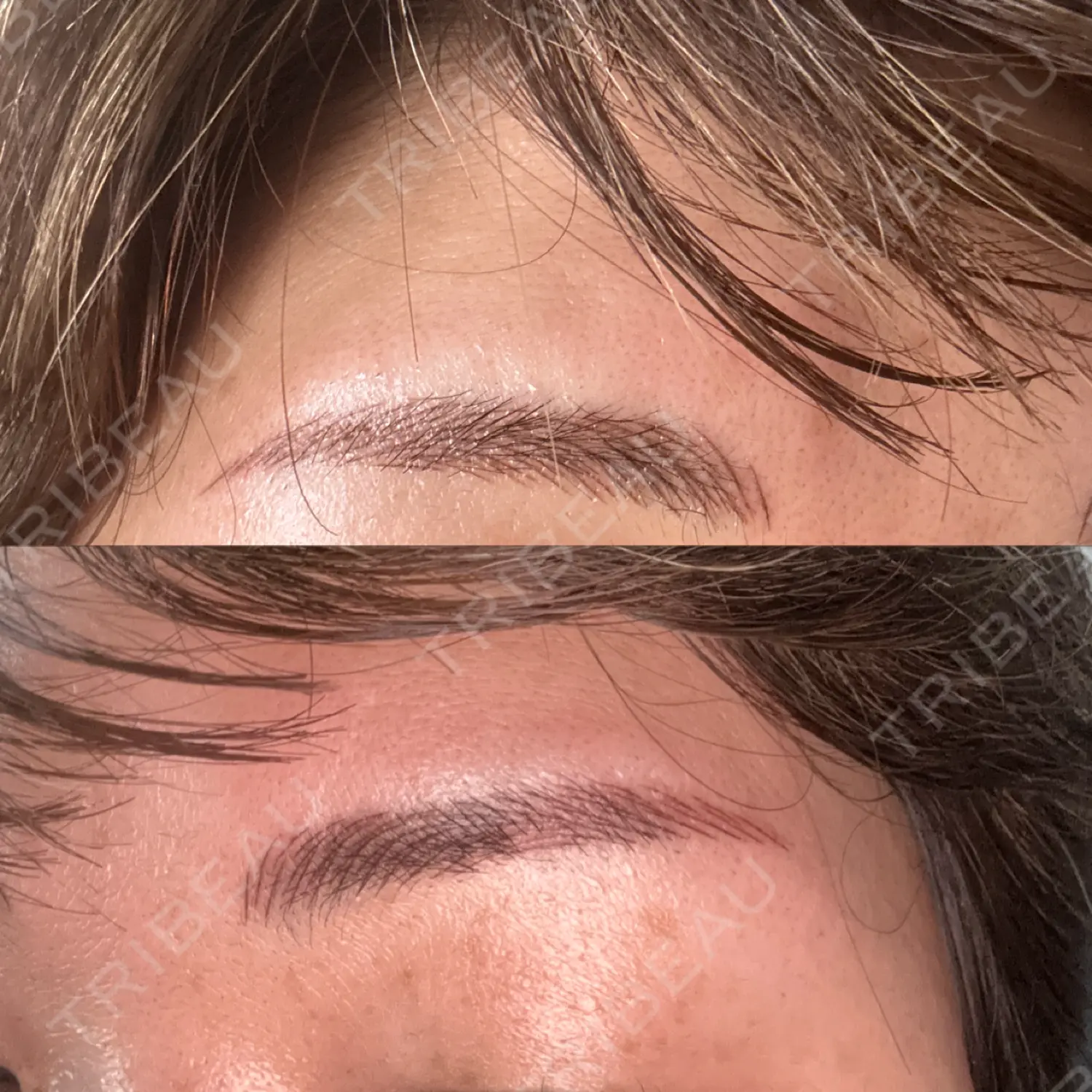 施術前の写真