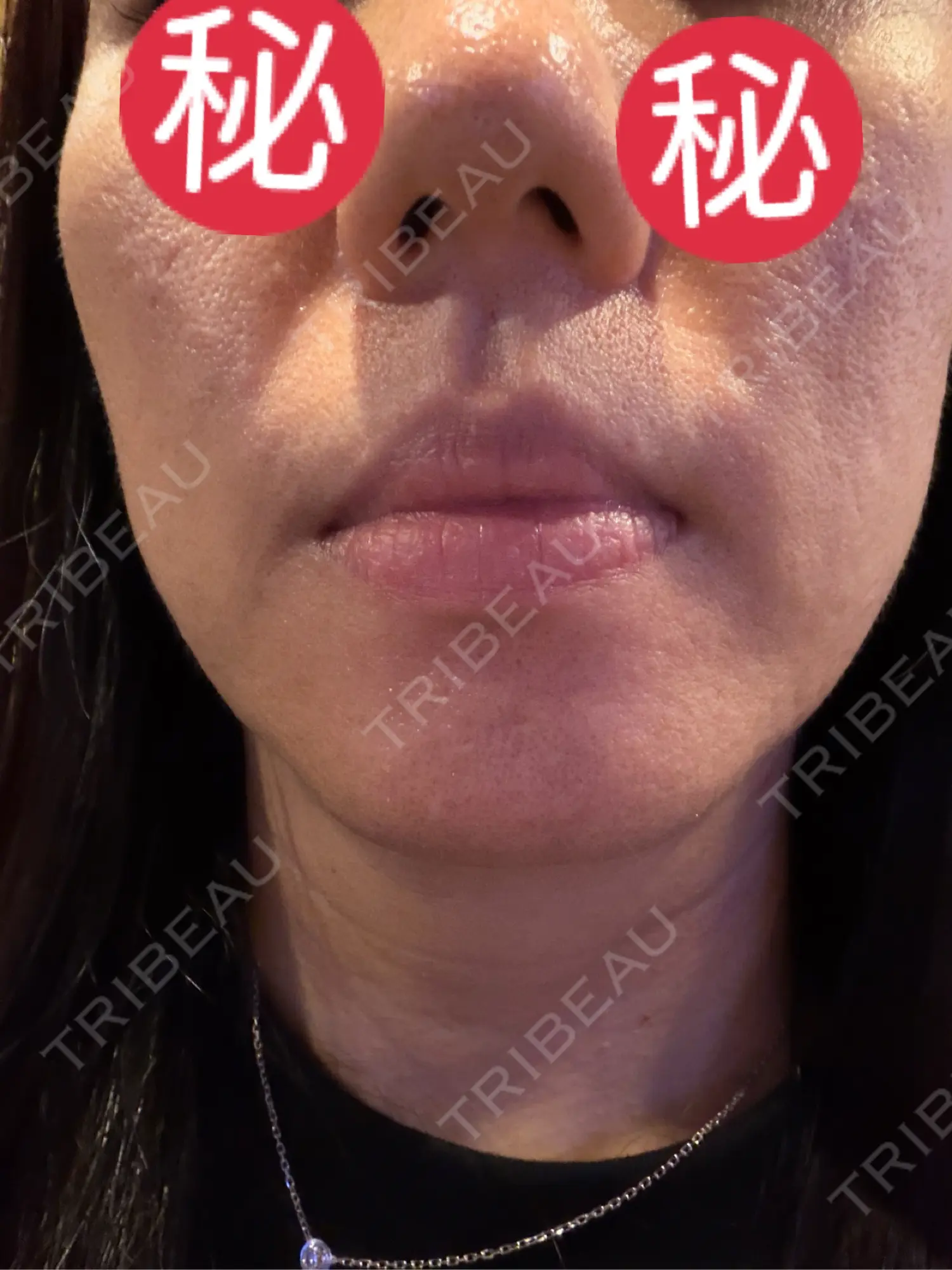 施術前の写真