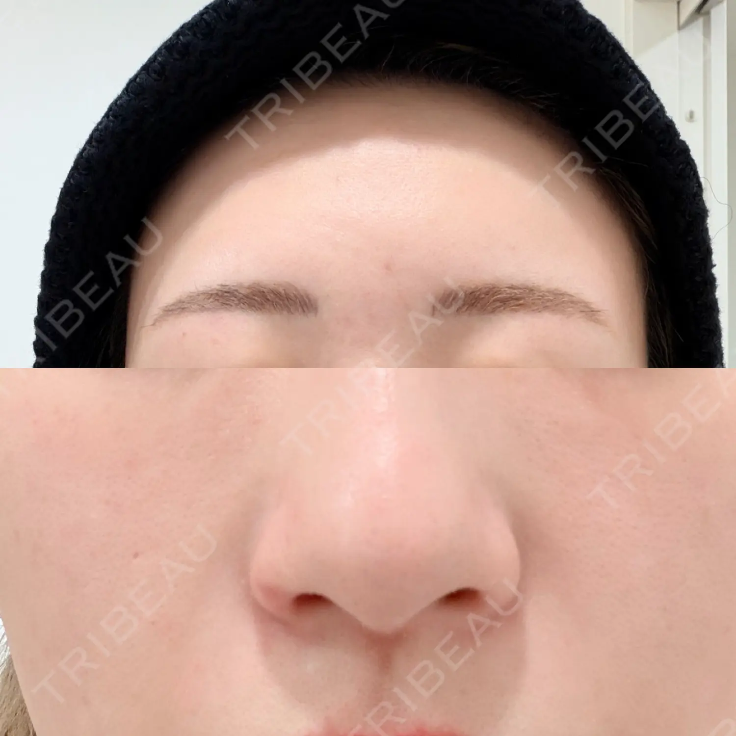 施術前の写真