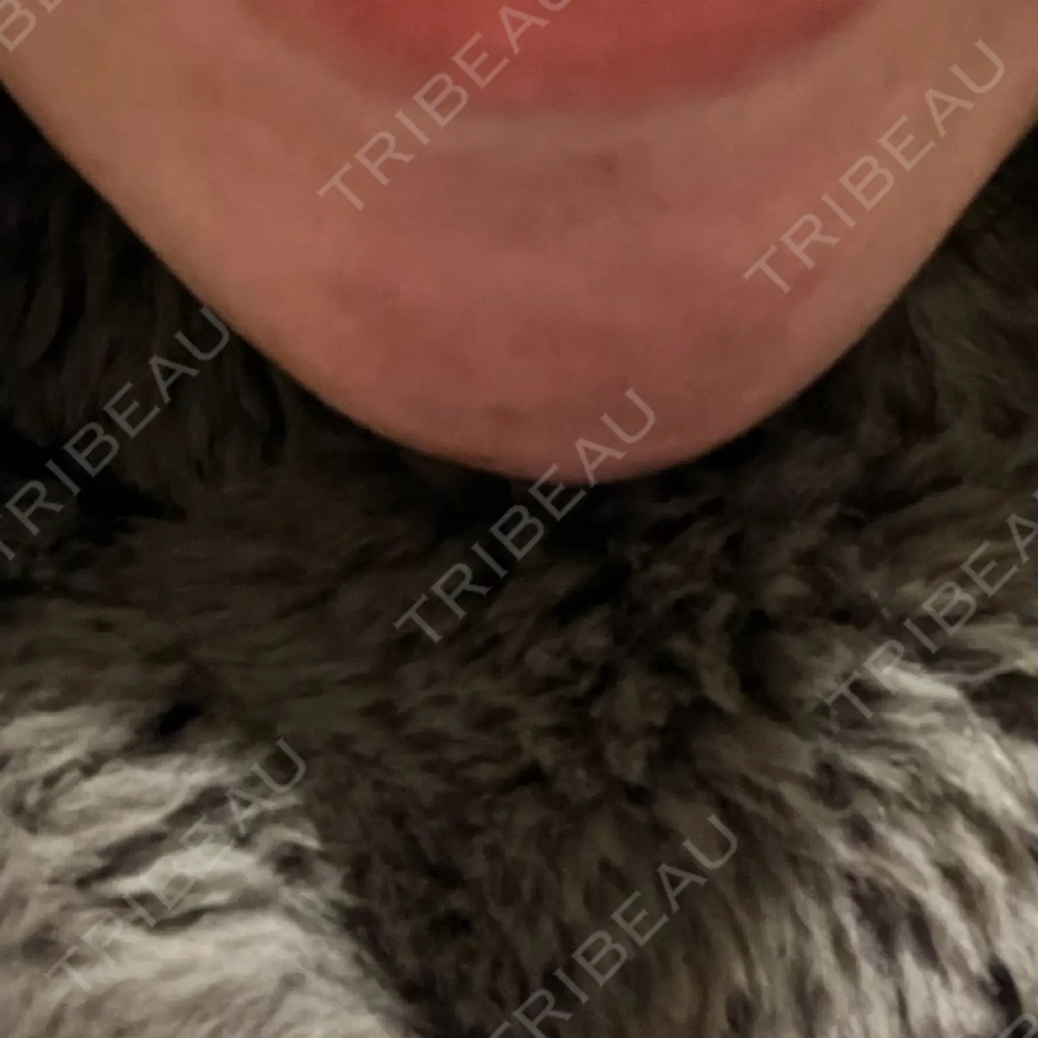 施術前の写真