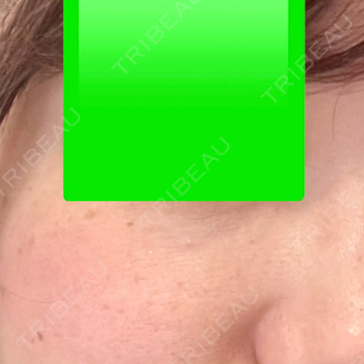 施術前の写真