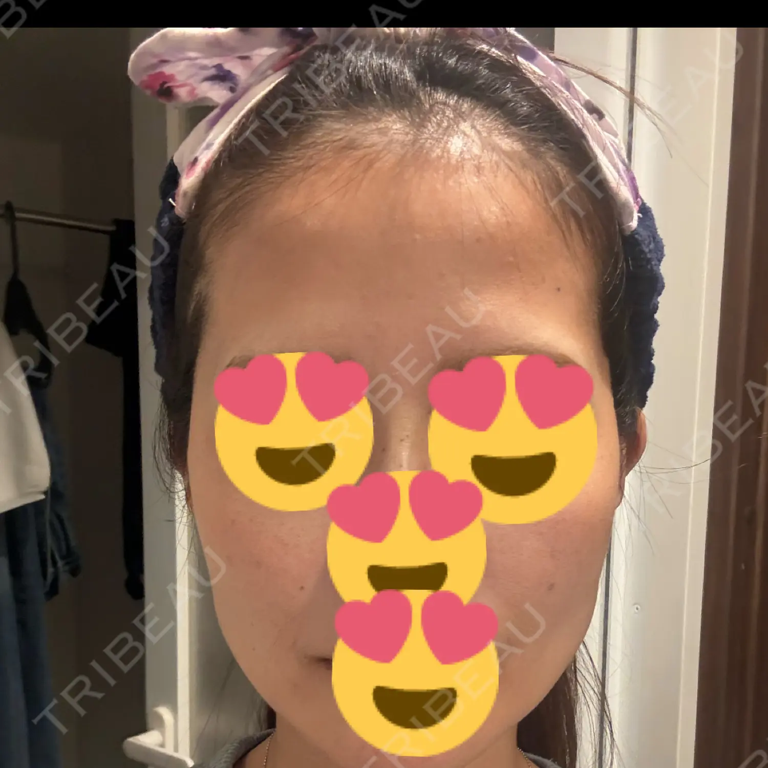 施術前の写真