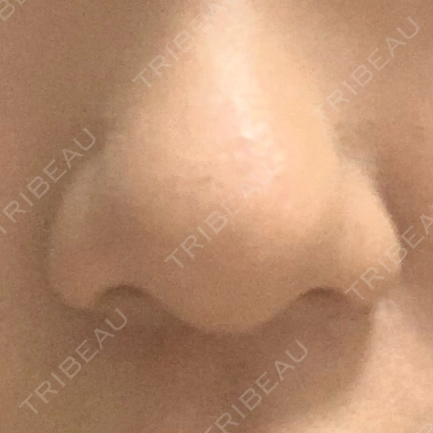 施術前の写真