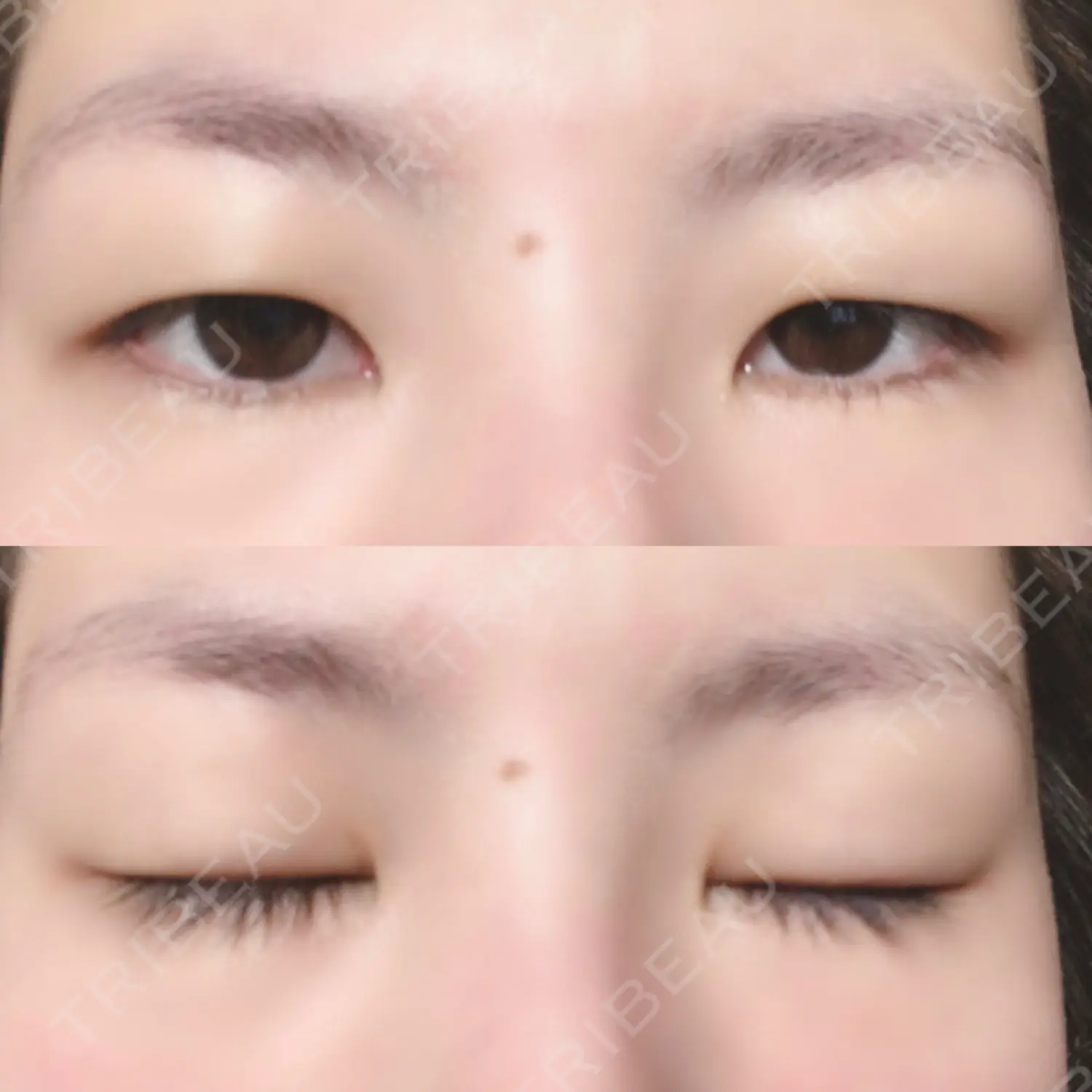施術前の写真