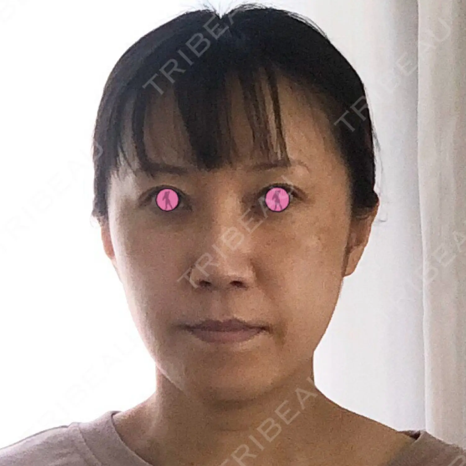 施術前の写真