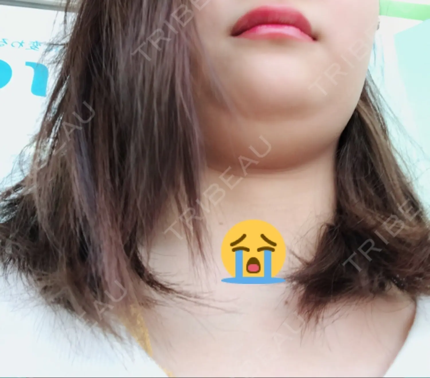 施術前の写真