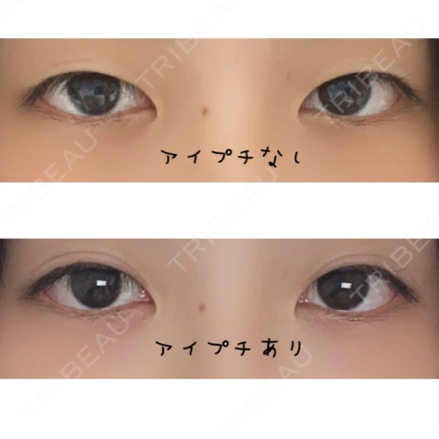 施術前の写真