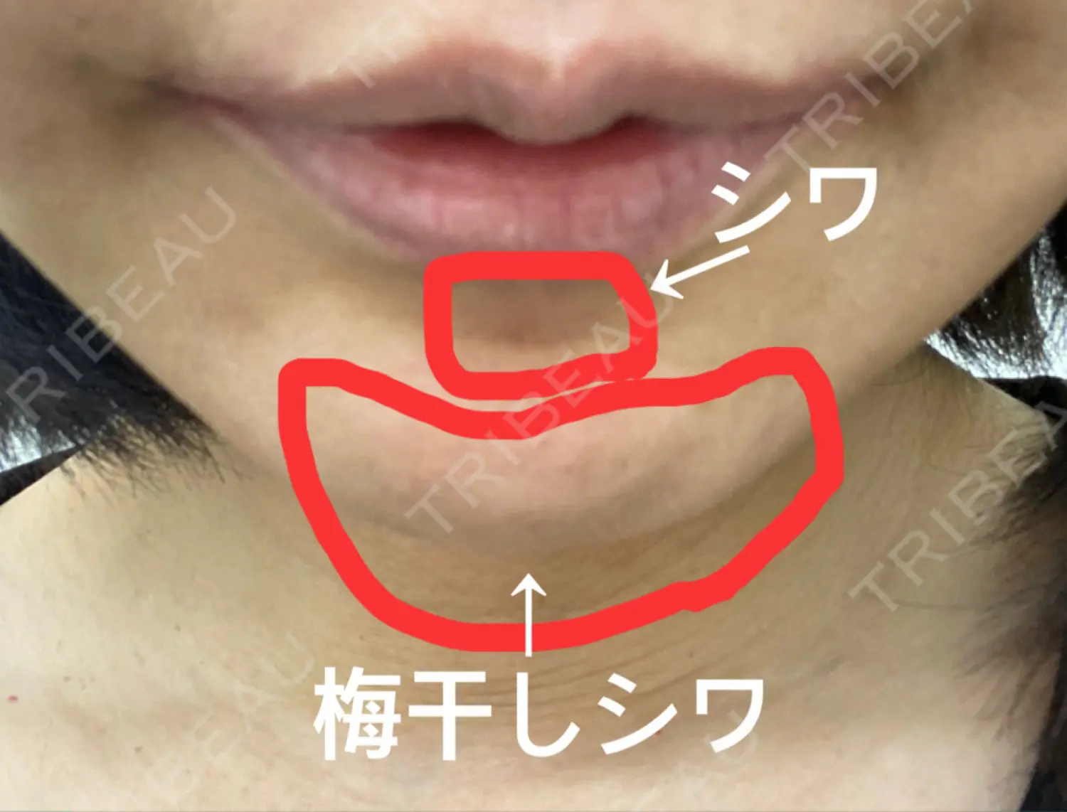施術前の写真