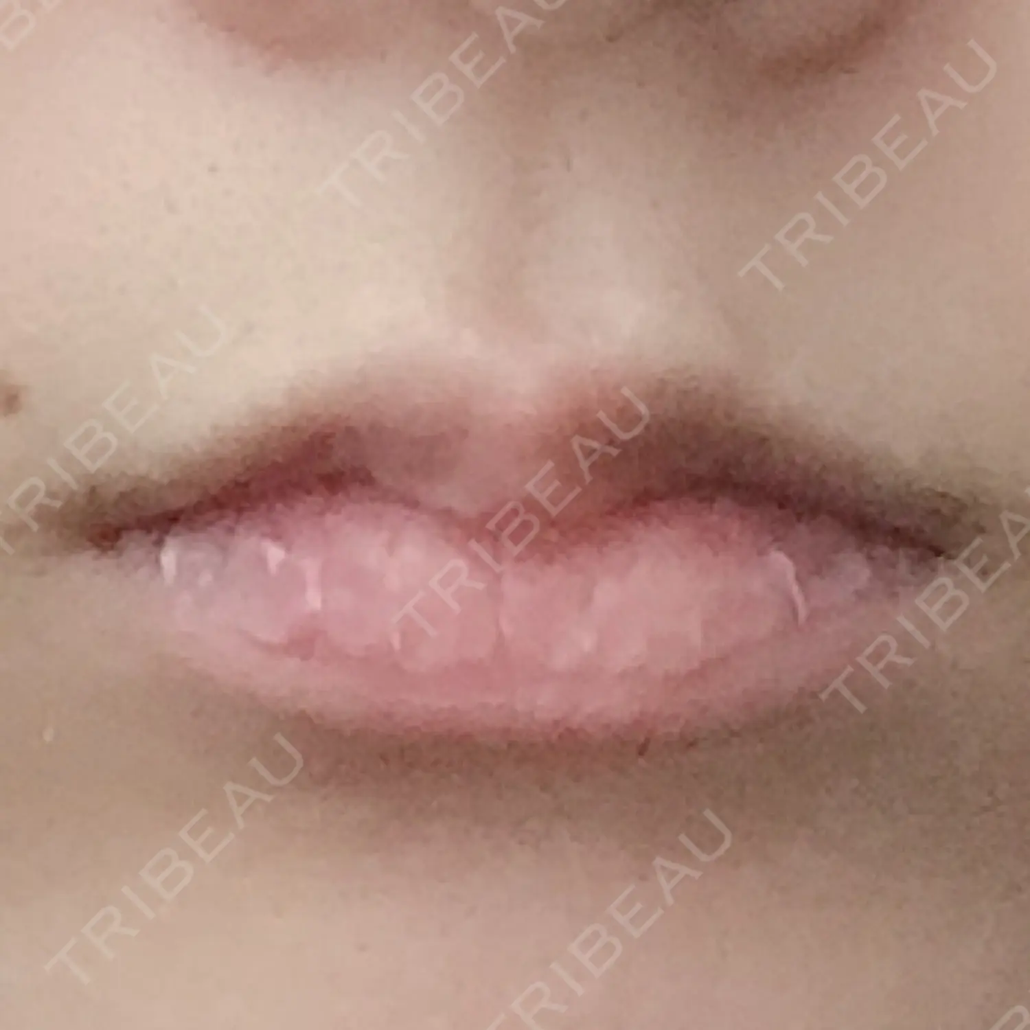施術前の写真