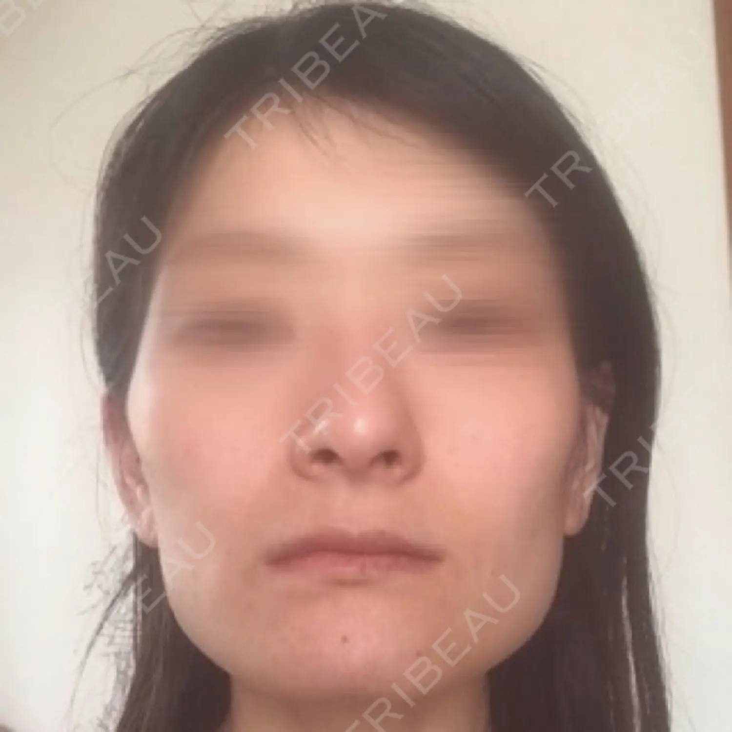 施術前の写真
