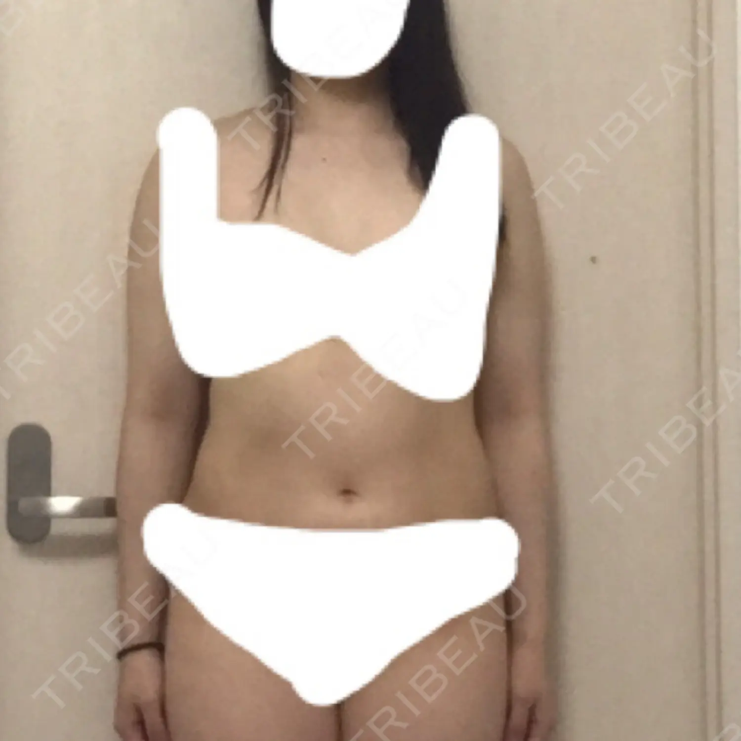 施術前の写真