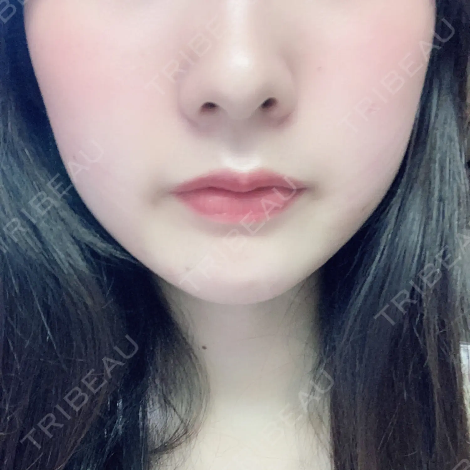 施術前の写真