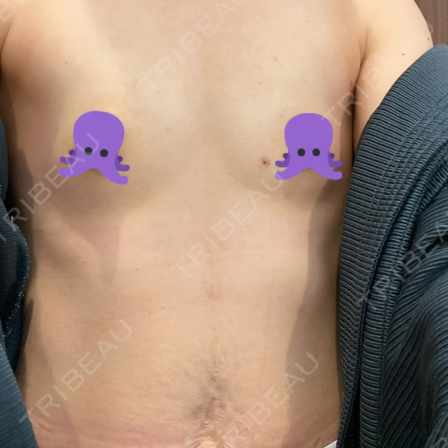 施術前の写真