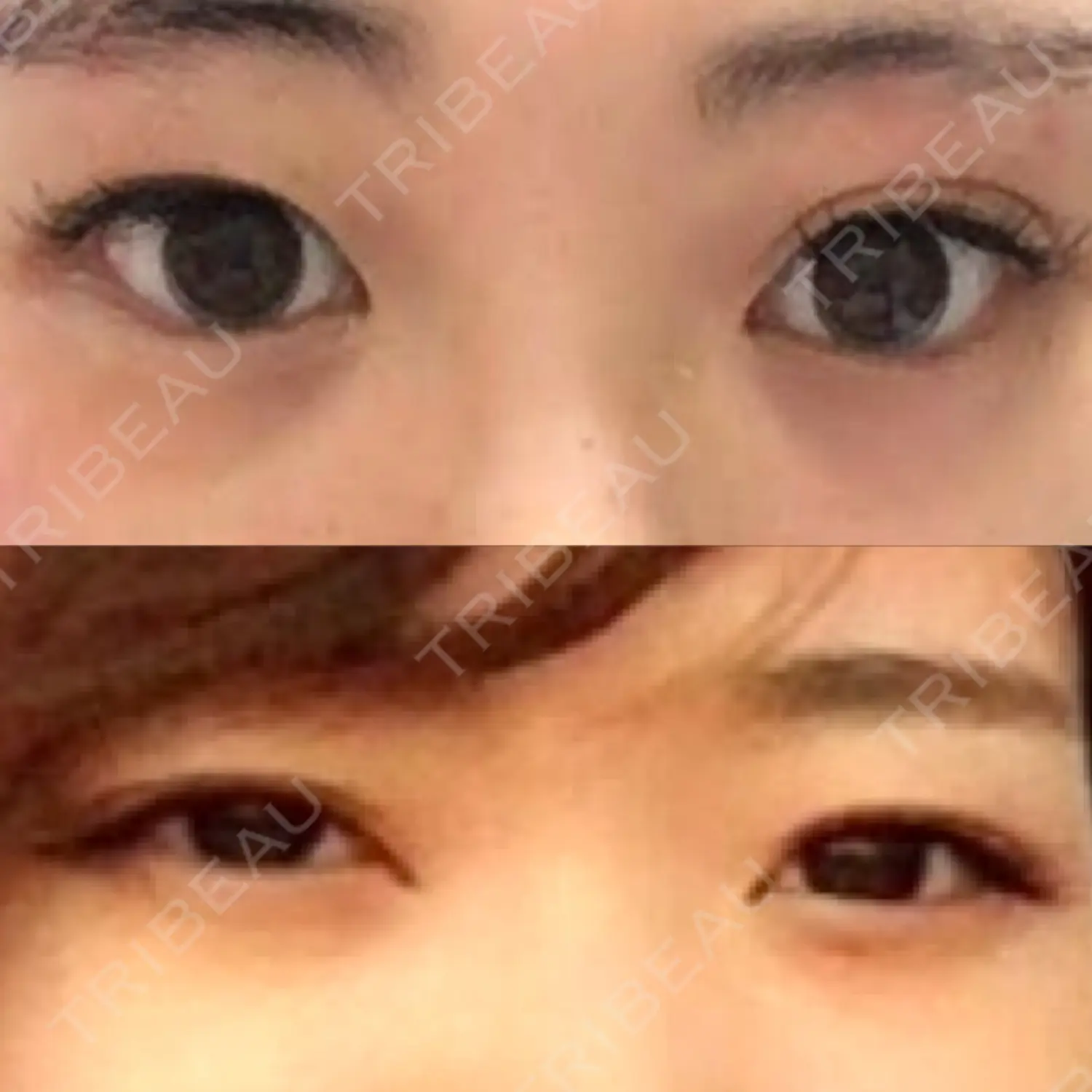施術前の写真