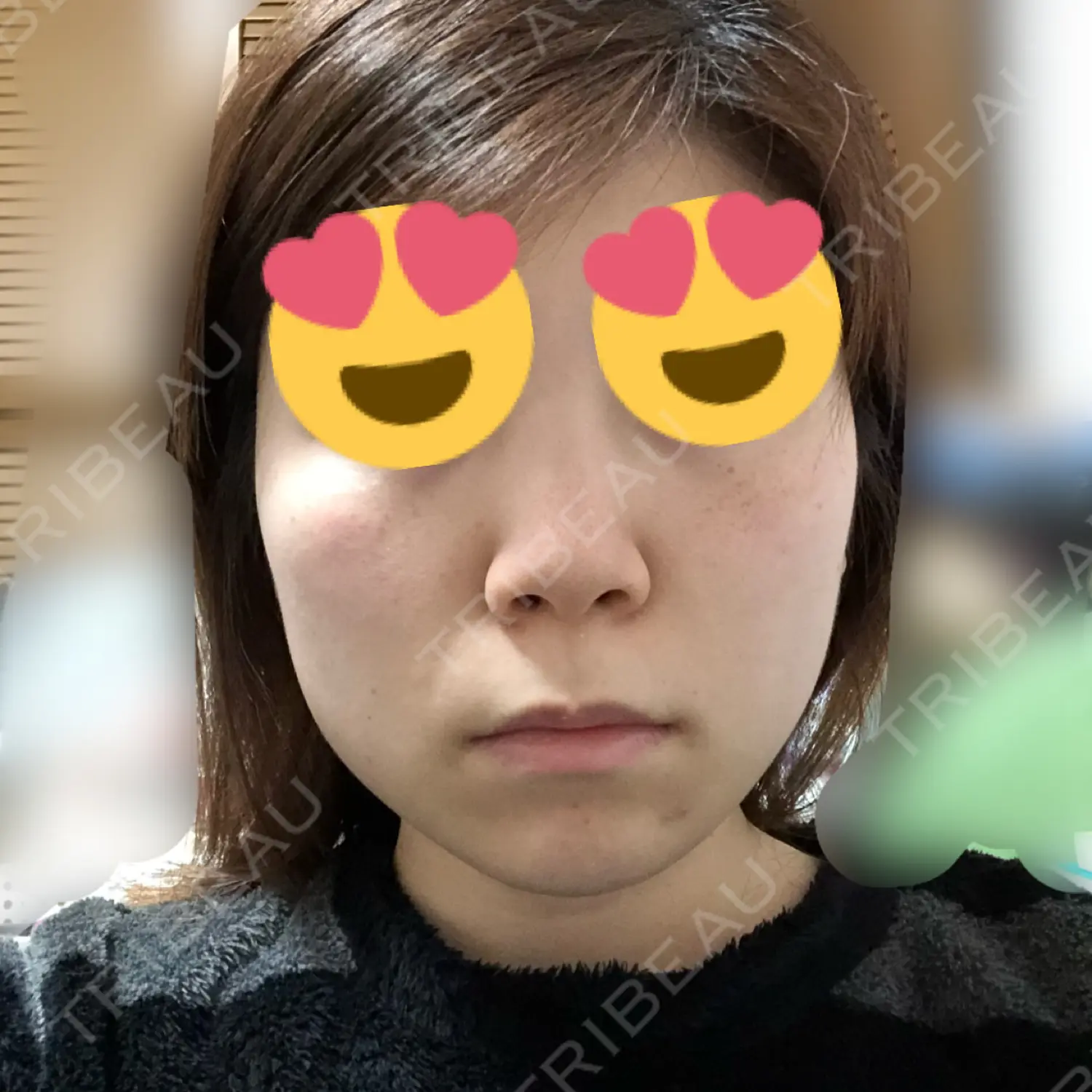 施術前の写真