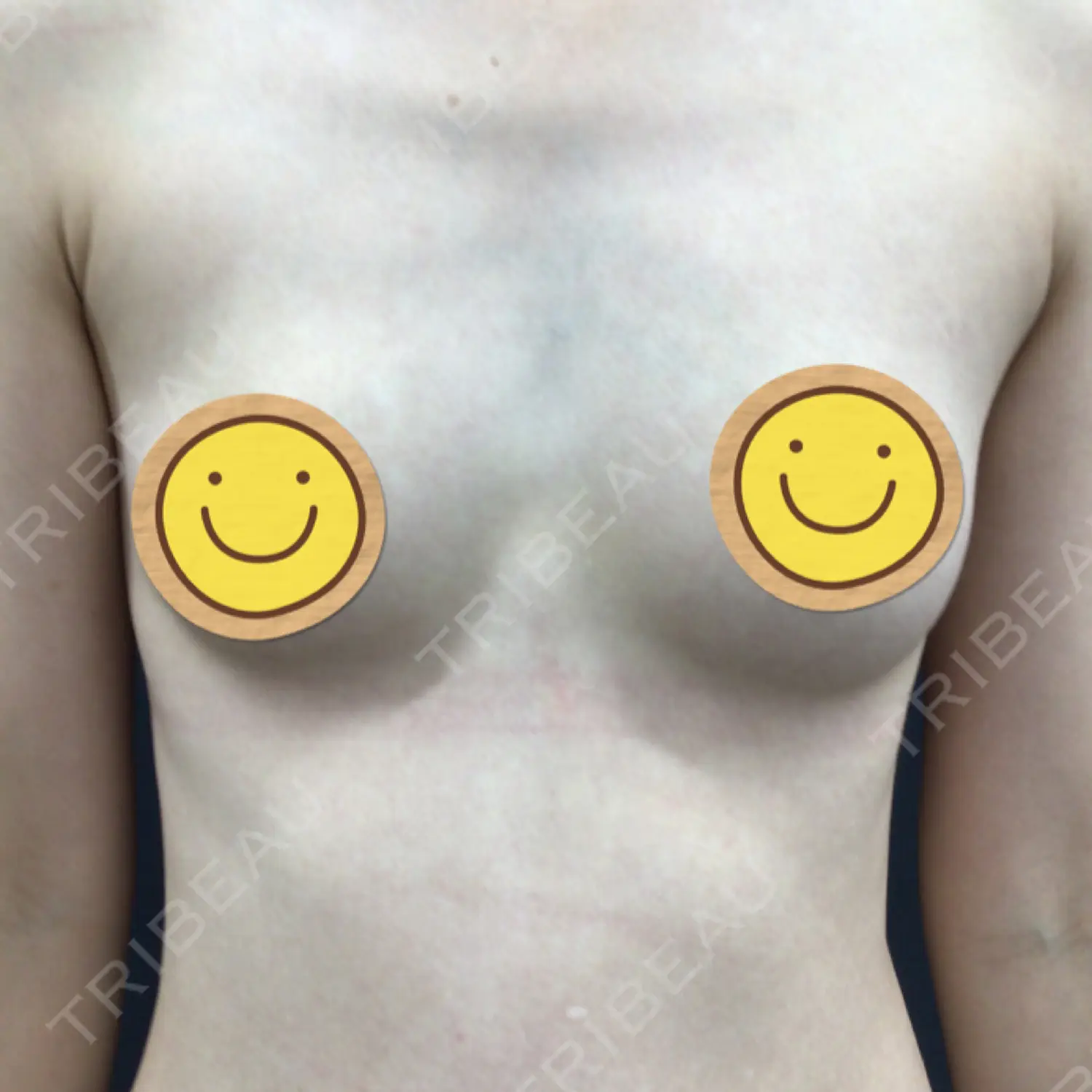 施術前の写真