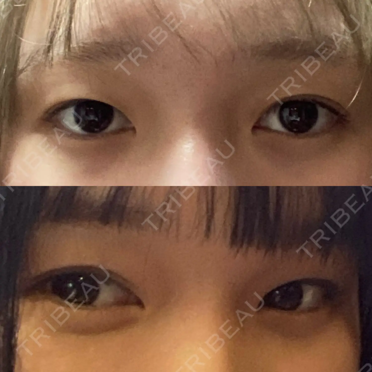 施術前の写真