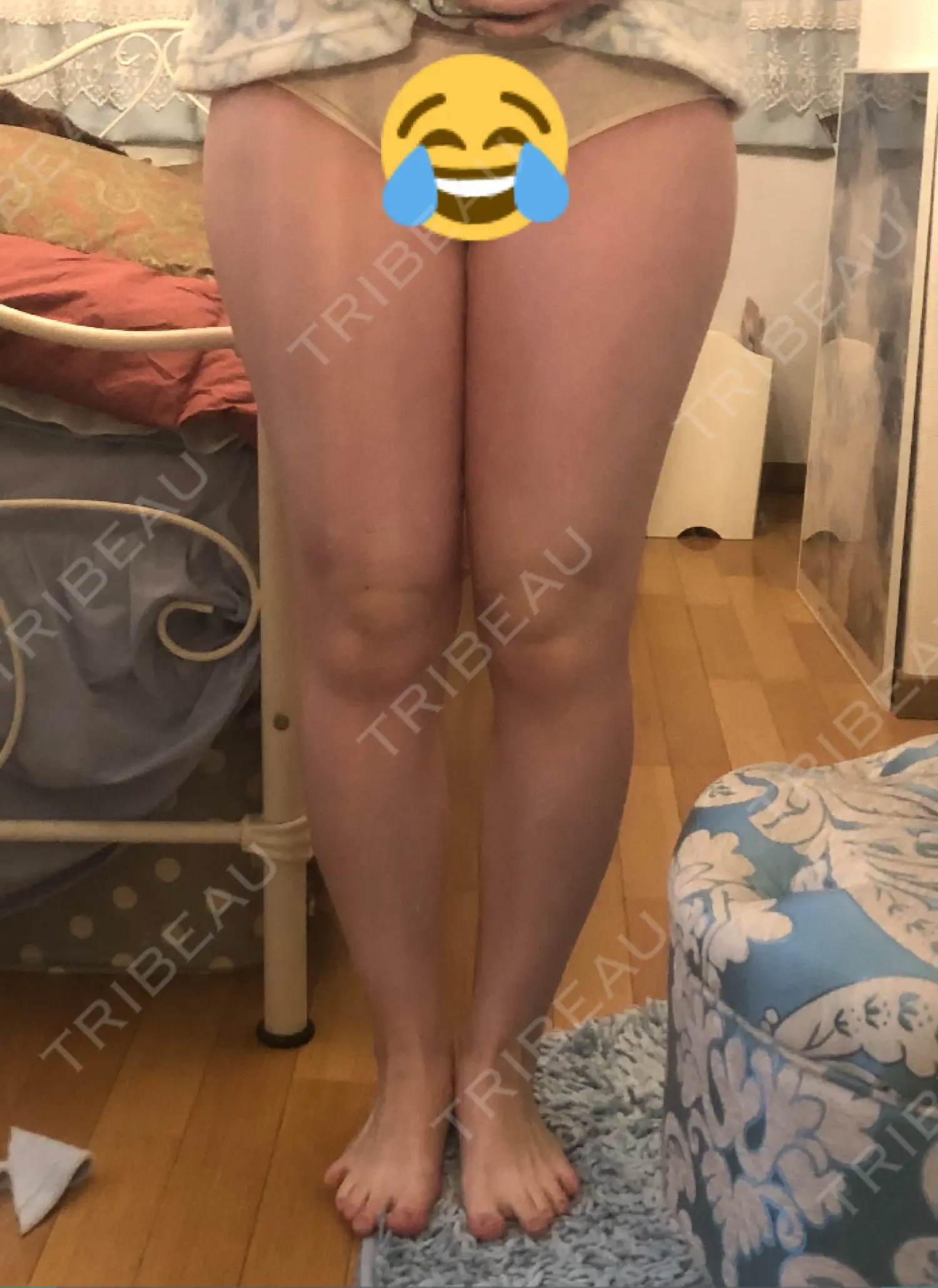 施術前の写真