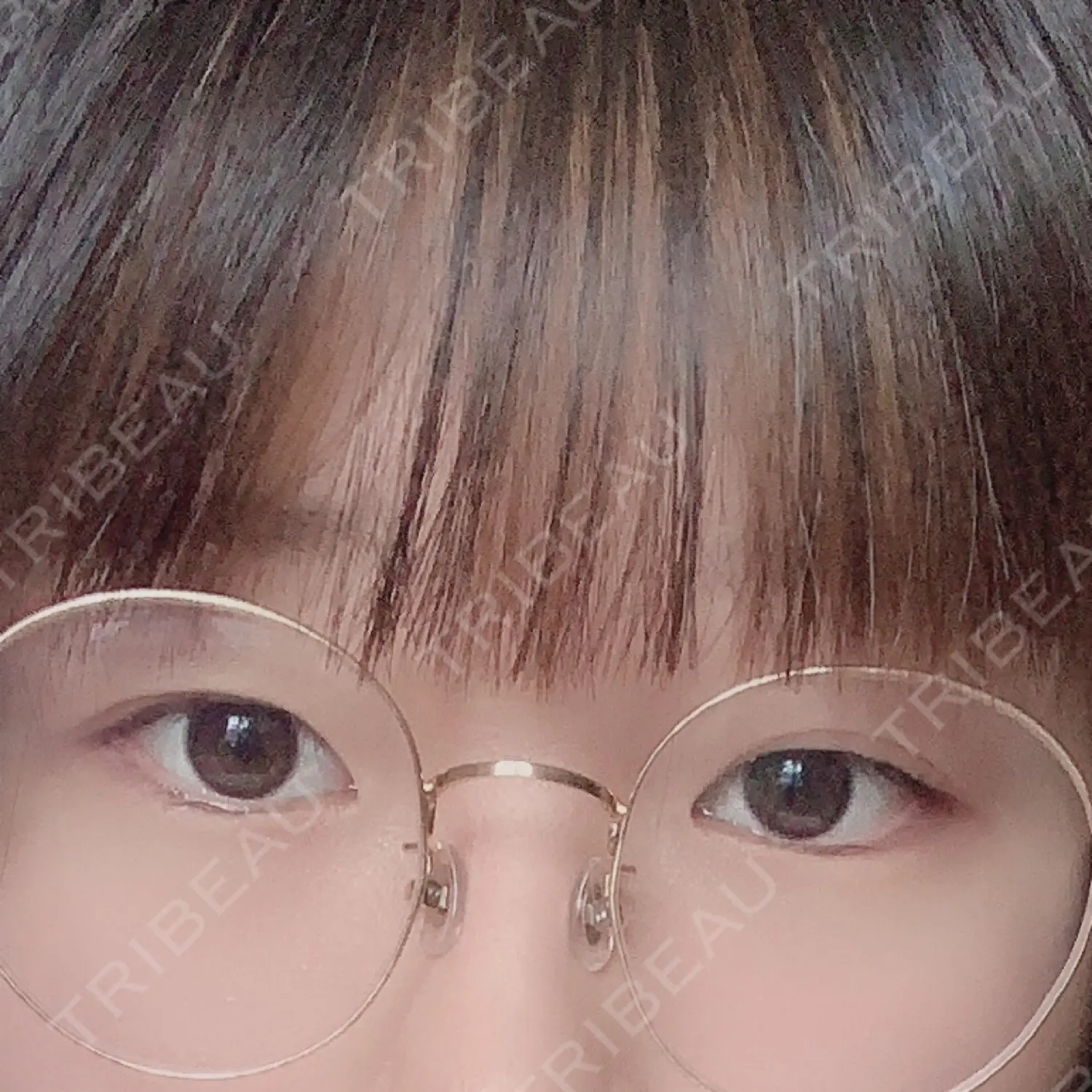 施術前の写真