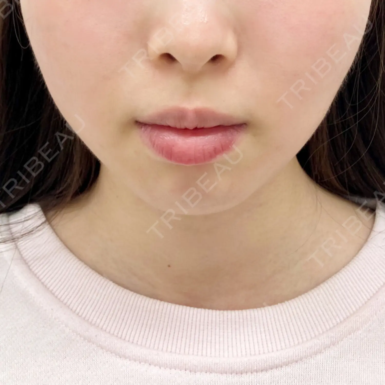 施術前の写真