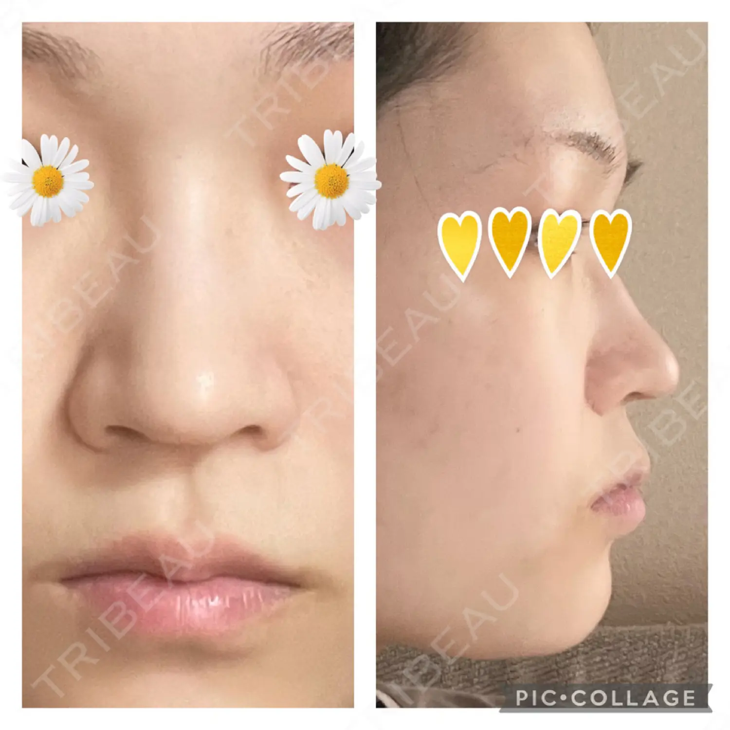 施術前の写真
