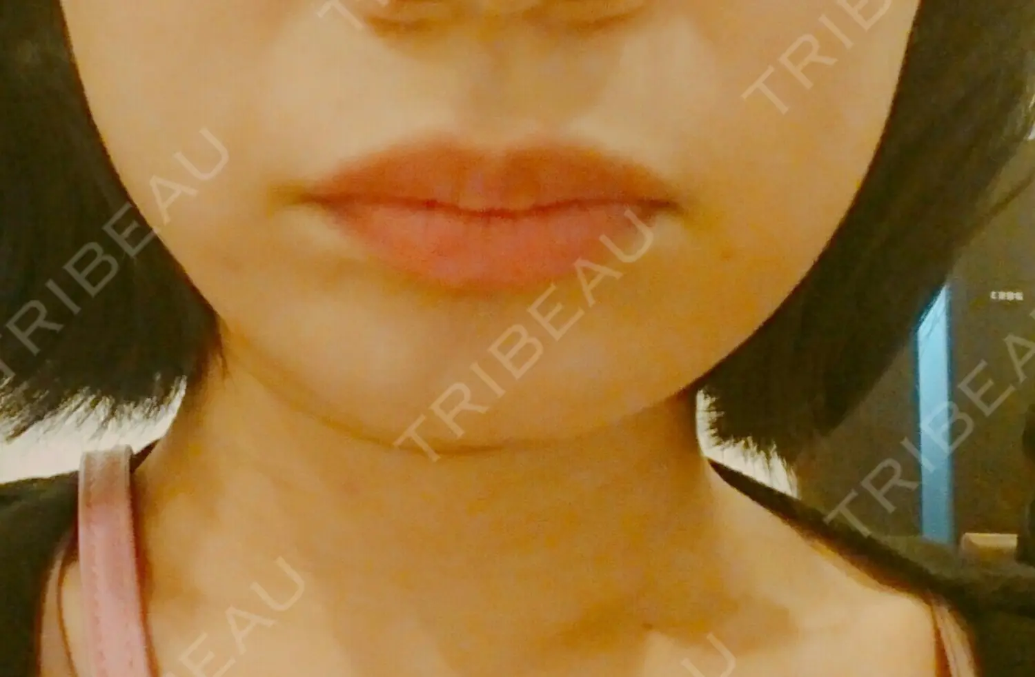 施術前の写真