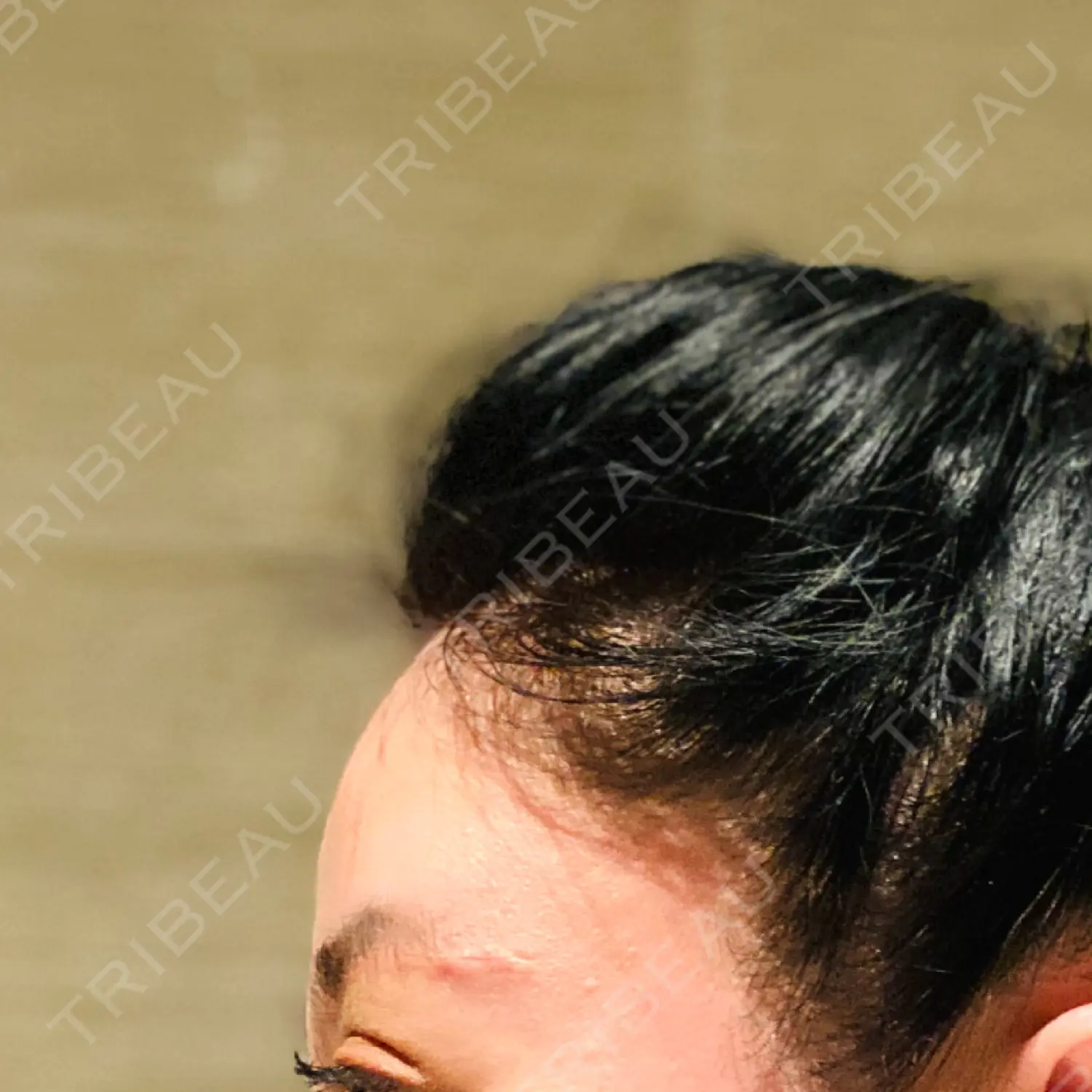 施術前の写真