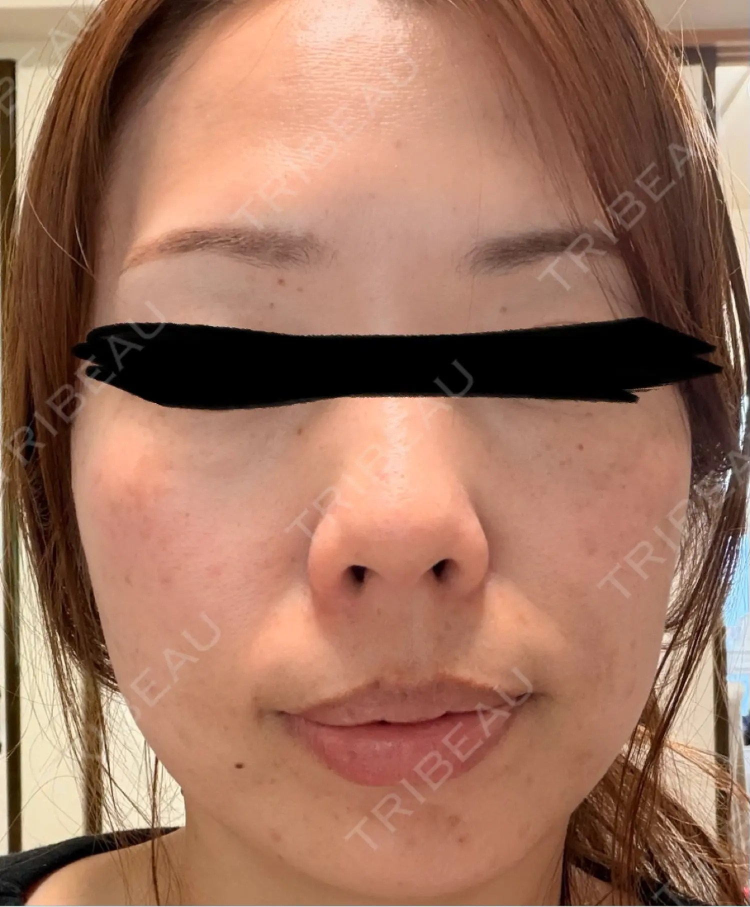 Natural Skin Clinic 笹塚院の口コミ495件・評価4.3｜料金・症例・予約 | トリビュー