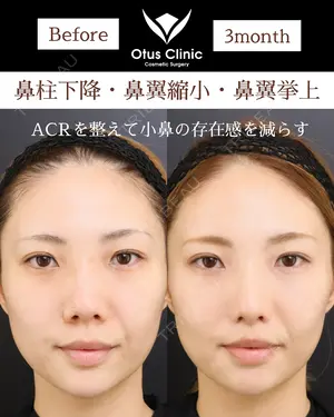 90 days after image