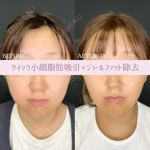 90 days after image