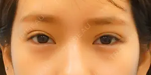 10 days after image
