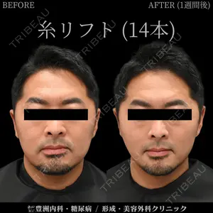 6 days after image