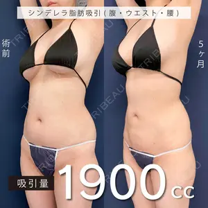 150 days after image