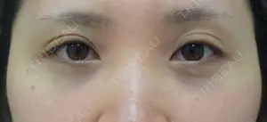 90 days after image