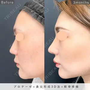 90 days after image