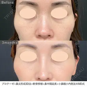 90 days after image