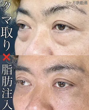 90 days after image