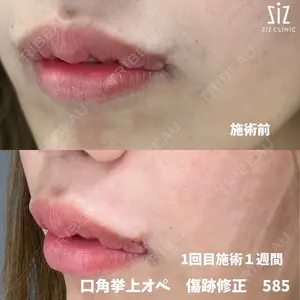 before image
