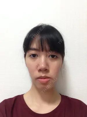 before image