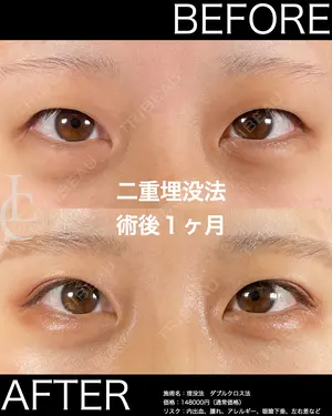 30 days after image