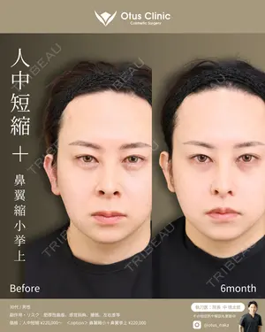 180 days after image